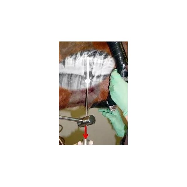 Buccotomy set advanced