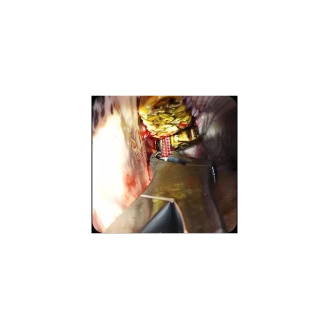 Set buccotomie basic